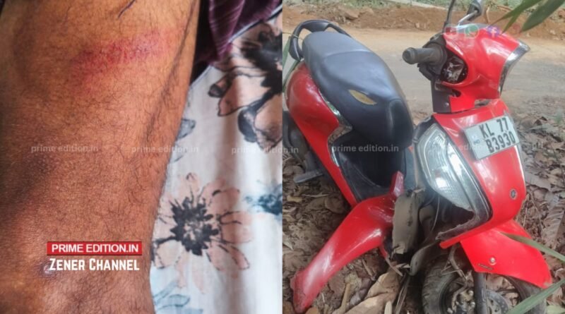 പെരുവണ്ണാമൂഴിയില് കാട്ടുപോത്ത് ആക്രമണം: ബൈക്ക് യാത്രികന് പരിക്ക് പെരുവണ്ണാമൂഴിയില് കാട്ടുപോത്ത് ആക്രമണം: ബൈക്ക് യാത്രികന് പരിക്ക്