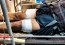 കൊയിലാണ്ടിയില്‍ മധ്യവയസ്‌കന് നേരെ ആക്രമണം: തര്‍ക്കം ചോദിക്കാനെത്തിയ വ്യക്തിക്ക് ഗുരുതര പരിക്ക്